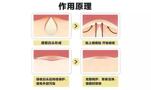 换季过敏烂脸爆皮用什么面膜,换季过敏脸上泛红长痘用什么面膜