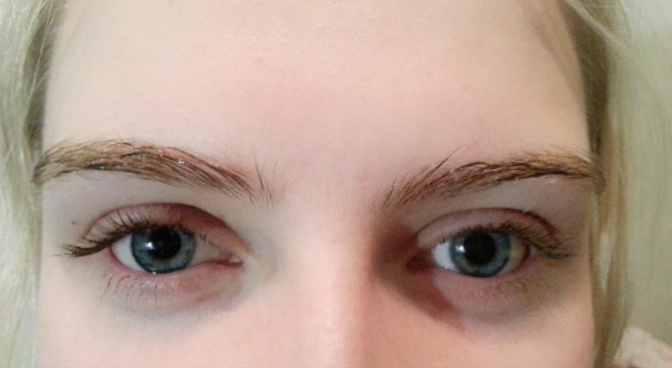 人工泪液频繁使用或加重干眼症,眼睛干涩滴生理盐水还是人工泪液