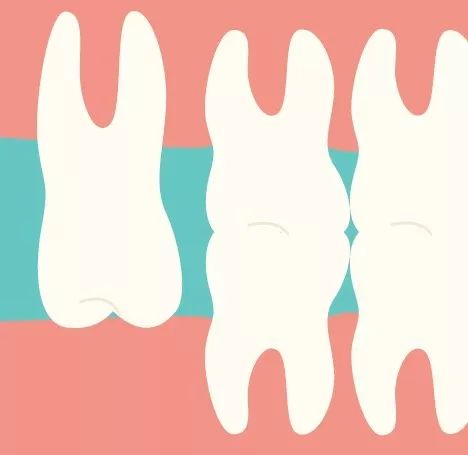 拔智齿术前麻醉后遗症,拔智齿前的流程及注意事项