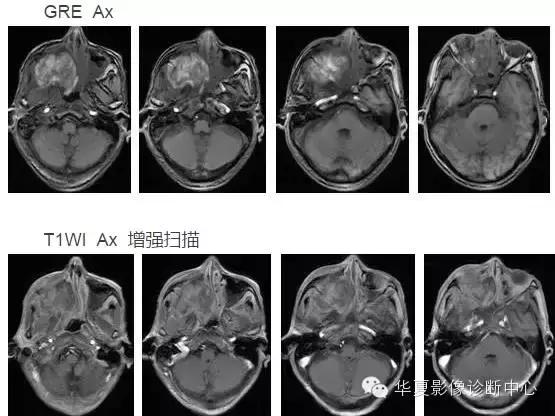 这些部位的黑色素瘤，您会诊断吗？