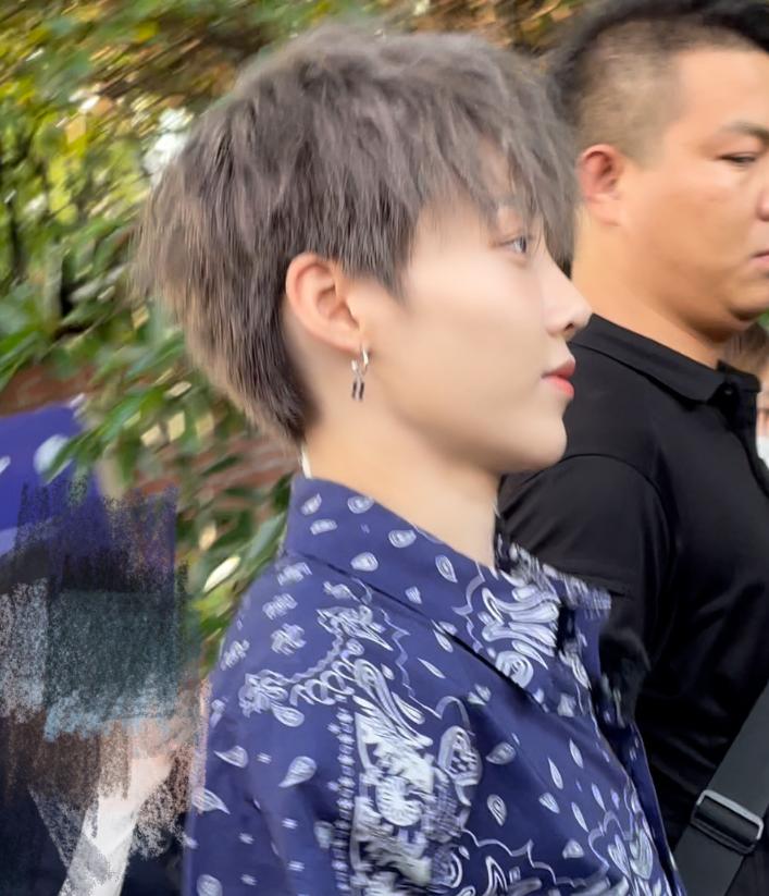 刘雨昕脸上有白点图片,刘雨昕脸上出现白点