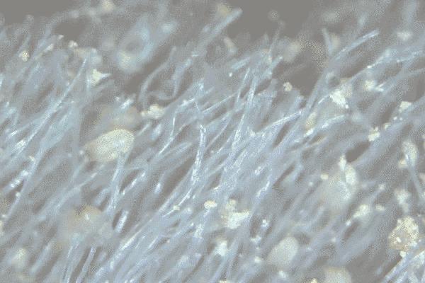 脸上螨虫引起的红点怎么消下去,宝宝身上的红点是螨虫引起的吗