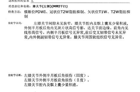 怎样能看懂膝关节核磁图片,如何看懂膝关节磁共振报告