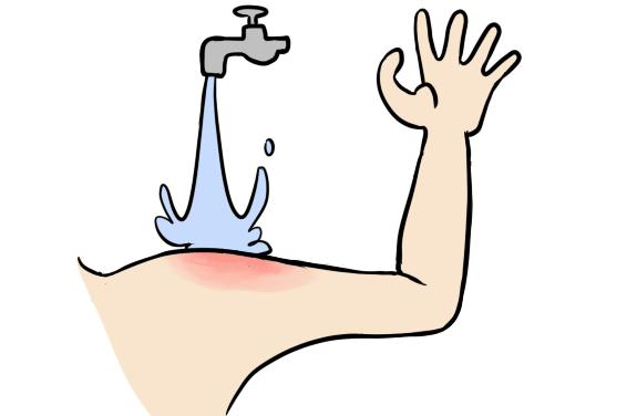 效果好又便宜常用药膏,几款管用的小药膏