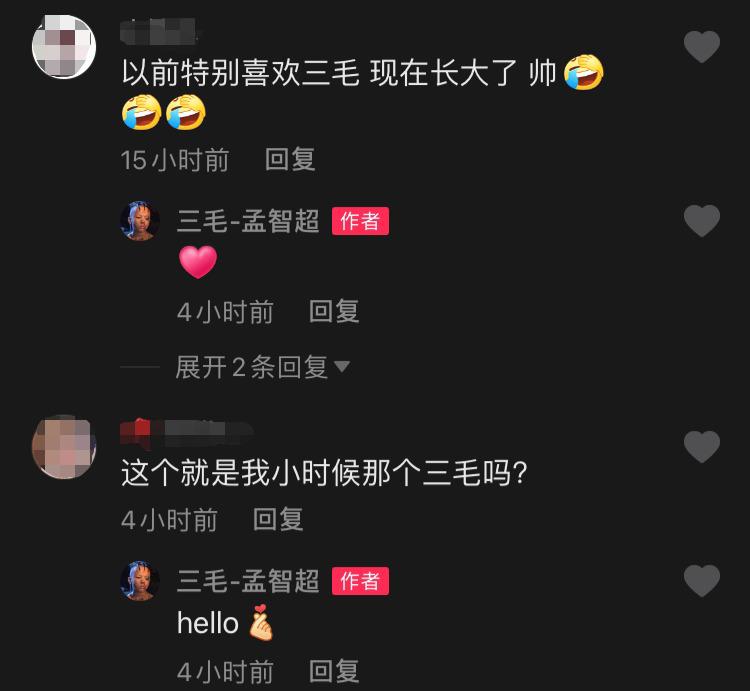 “三毛”34岁了！8岁爆火，14岁谢顶，植发挨300多针，如今变帅哥