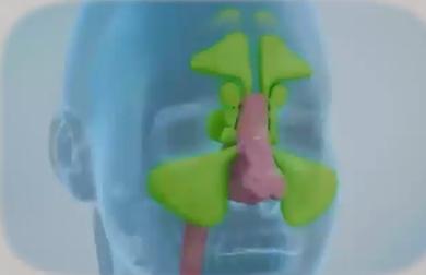 鼻窦炎怎么治疗协和,北京五官科专家治疗鼻窦炎