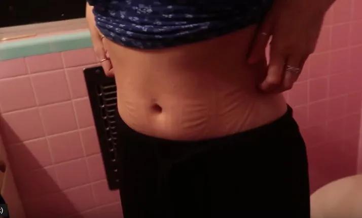 “内脏下垂、子宫脱落、漏尿…”：扒一扒你不知道的网红束腰