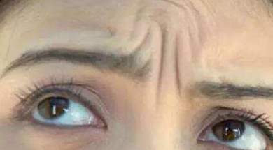 面部肌肉深度表情训练,面部肌肉训练表情不自然