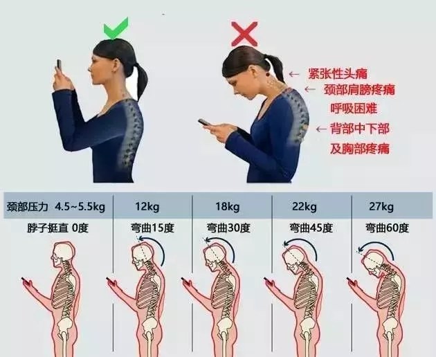 有多少脊椎病，是按出来的？