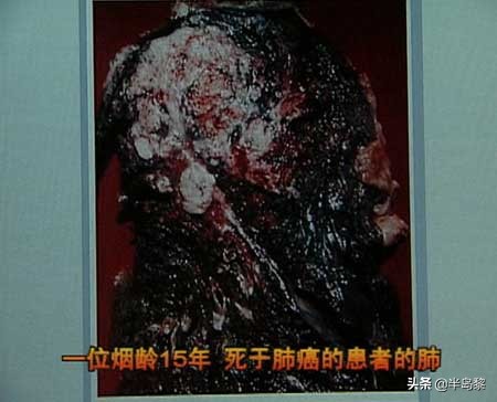 把烟头放装水的瓶子里会爆吗,烟头放在装水的瓶子里有危险吗