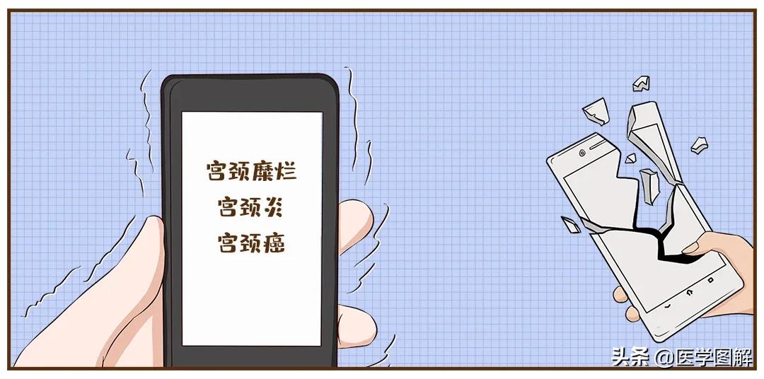 肉眼能判断宫颈糜烂,医生肉眼判断宫颈糜烂