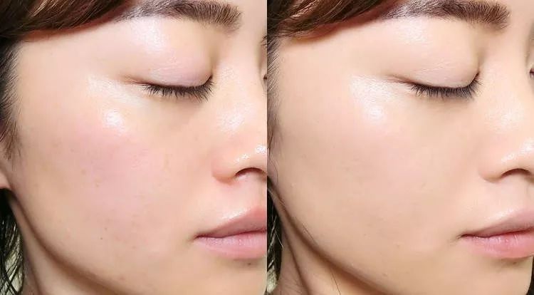 气垫大夏天测评,气垫比拼