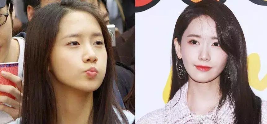 日本的美白针,日本最强美白针