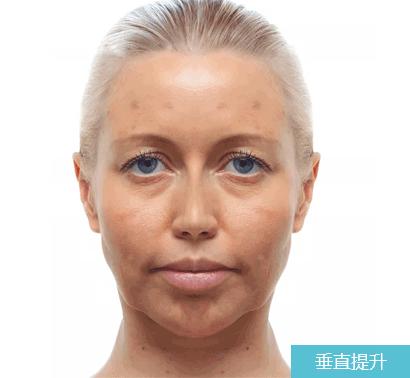 鼻翼两侧法令纹一道红沟,鼻翼两侧的法令纹有何说道