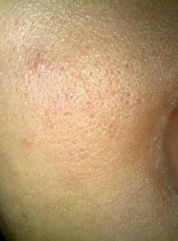 毛孔出油粗大如何改善小技巧,怎么应对肌肤毛孔粗大