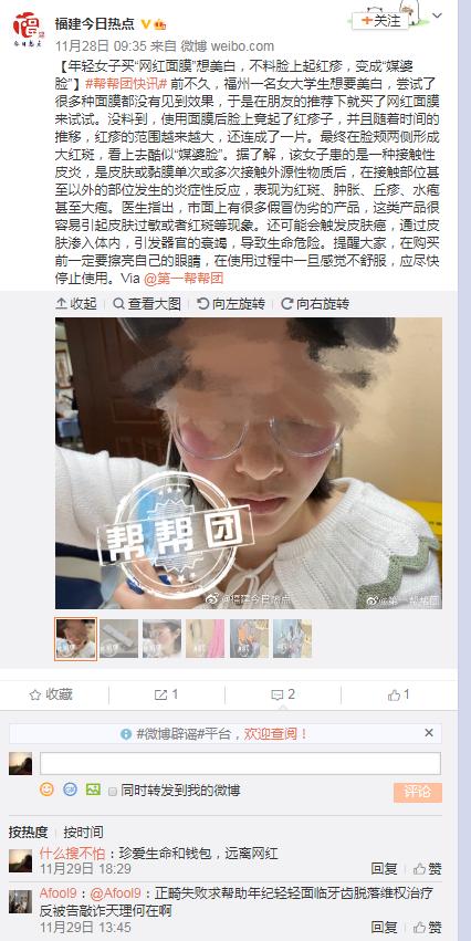 女子买美白面膜,23岁女子购买美白面膜