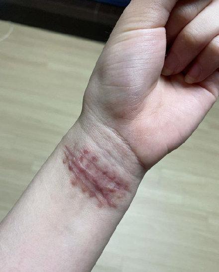 韩国遭霸凌女运动员自杀,韩国女运动员被害