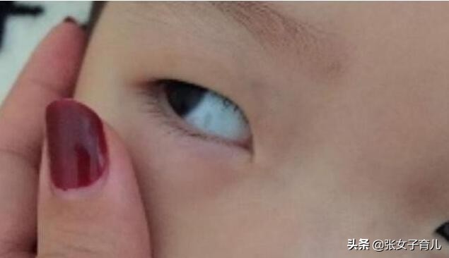 4岁宝宝眼白有黑点是怎么回事,三岁宝宝眼白有黑线是怎么回事