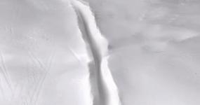 日本牙齿再生牙膏,牙齿咬东西酸软无力用什么牙膏