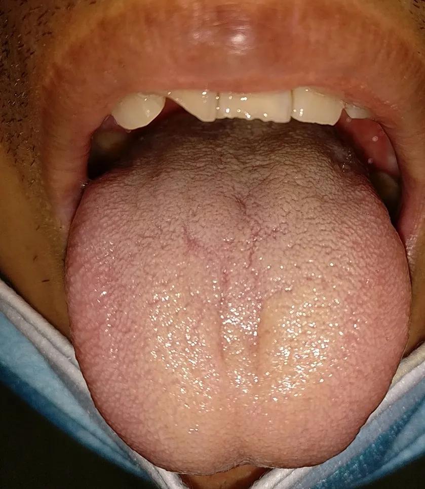 医生建议早上喝水好吗,医生建议早上不能空腹喝水