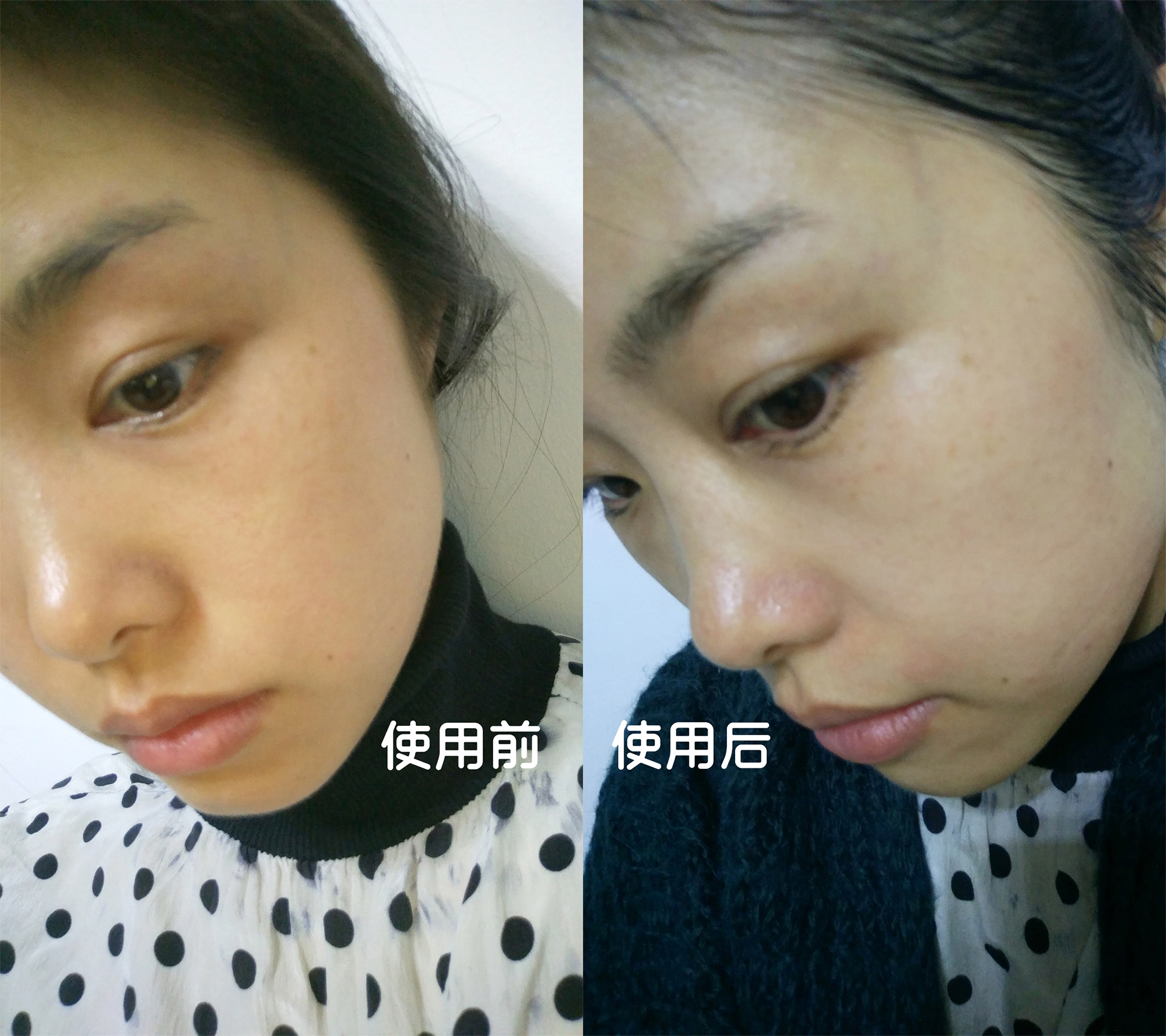 石墨烯美容黑科技，拥有了它，美了全家——若水石墨烯轻颜嫩肤仪