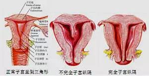 怎样的子宫内膜适合怀孕？吃柚子能长内膜？