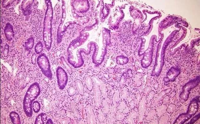 普洱市人民医院有肠镜检查,普洱市人民医院肠镜检查