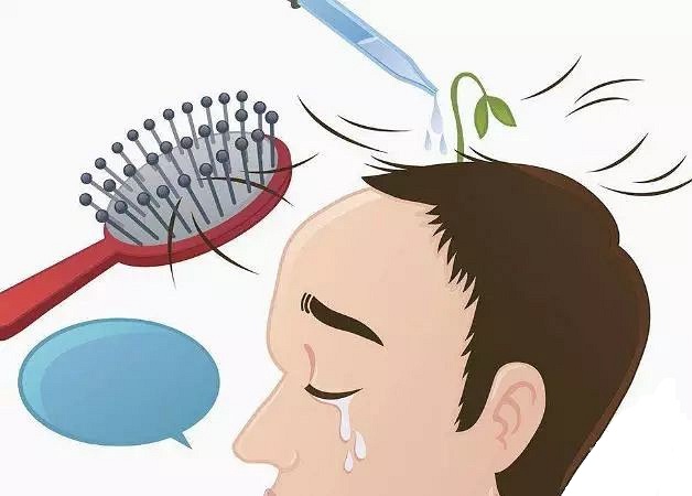 脱发十个有九个是脂溢性,十油九脱