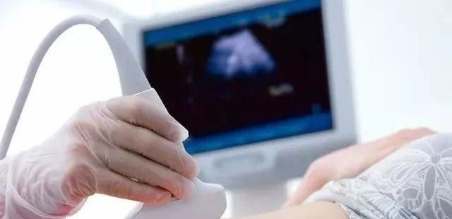 教你看懂怀孕b超单,为什么孕检b超单内容这么简单