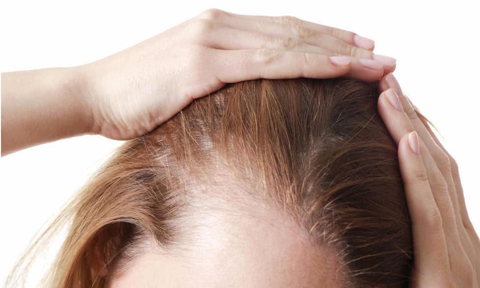 贝克汉姆脱发,贝克汉姆被曝脱发角度问题