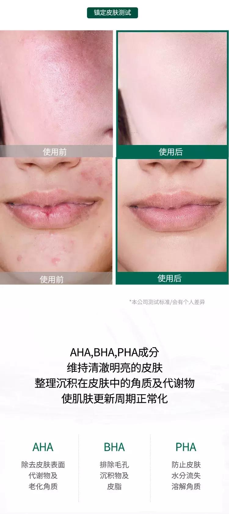 somebymi茶树精华测评,somebymi茶树精华能淡疤吗