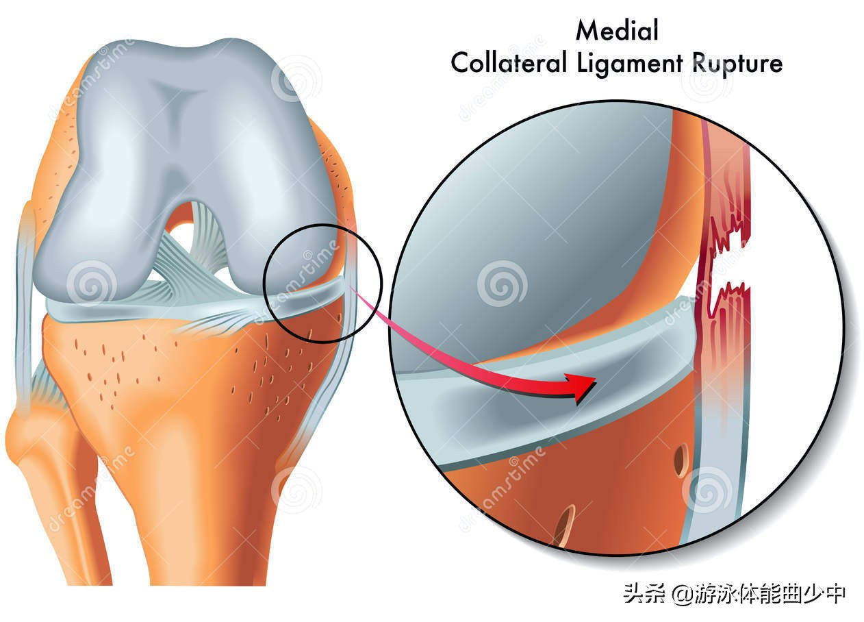 潜水膝关节疼痛,潜水导致膝盖内侧疼痛怎么解决