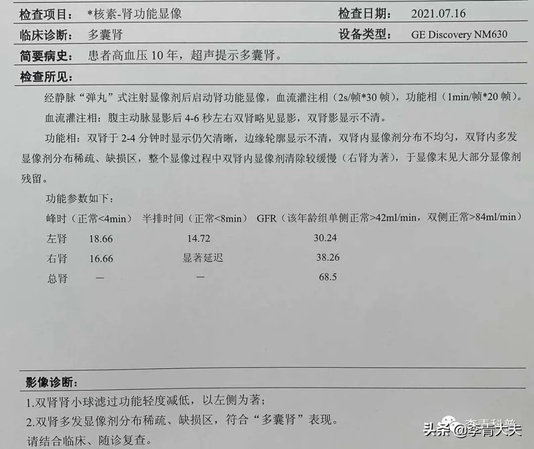 新药治多囊肾,多囊肾治疗的新药