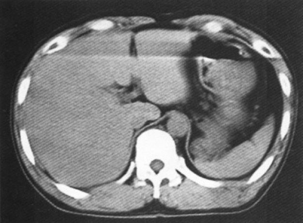 ct图像解析大全,ct图像与实物大小对比