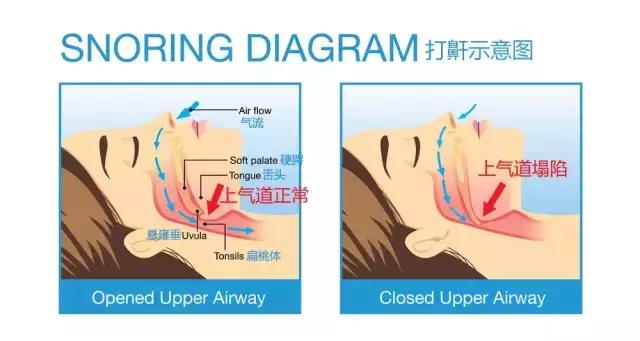 梦游鬼压床有时抖一下,睡觉时候鬼压床嘴抖动说不出话
