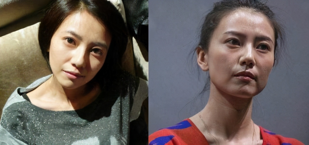 面部法令纹显老怎么改善,法令纹显老10岁三种方法帮助缓解