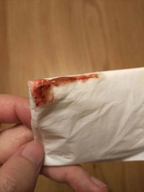猫便便是黑色的如何在家救治,幼猫拉粪便带血丝是怎么回事