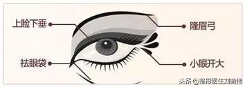 眼睛手术的坑，不要往里面跳了