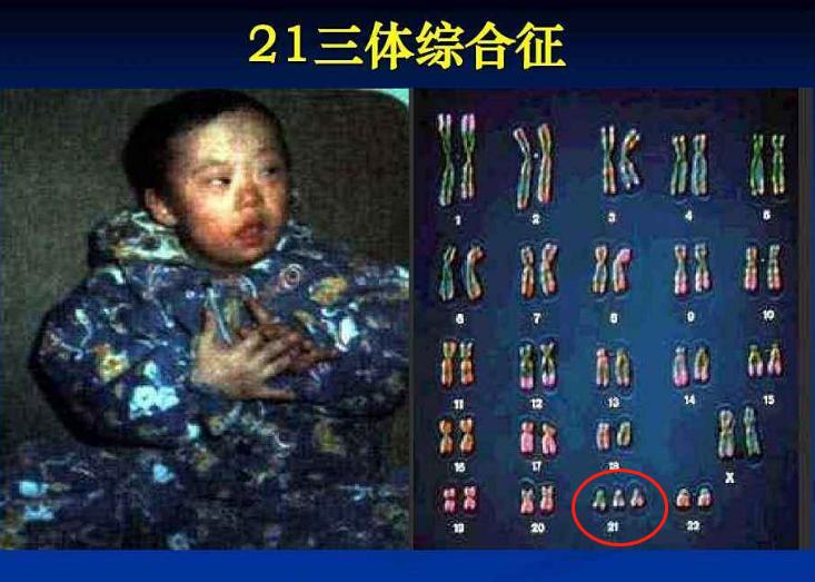 孕中期产检都有哪些项目,孕中期产检项目及最佳检查时间