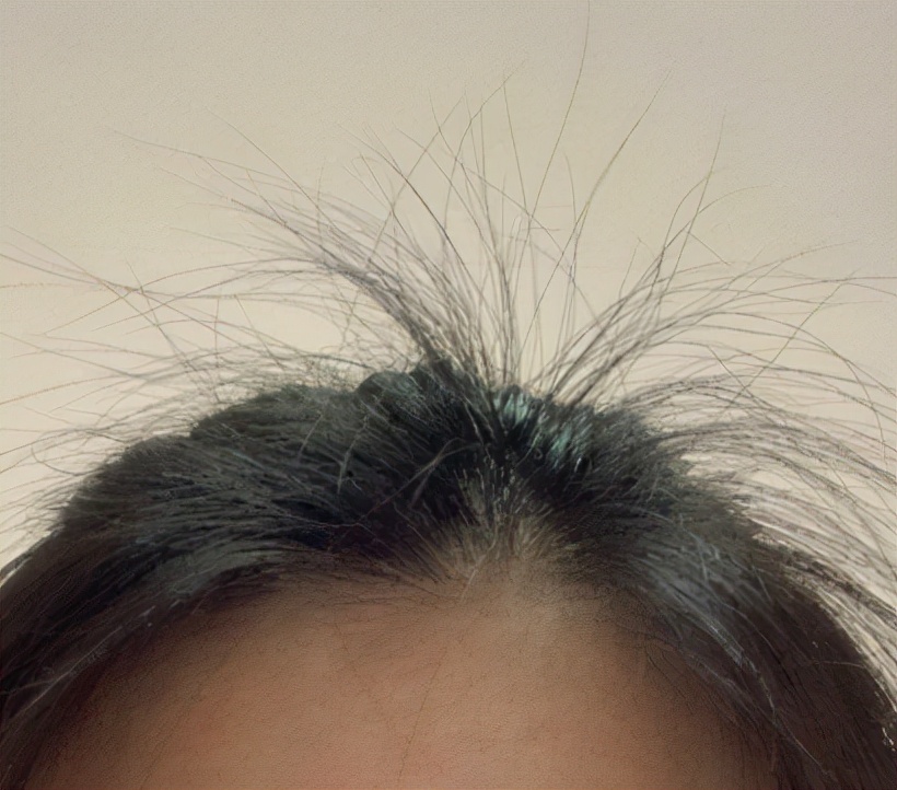 让头发蓬松的喷雾,用发卡让头发蓬松