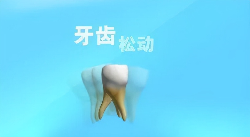 牙齿松动是什么原因怎么治疗,牙疼时牙齿会松动不疼时不松动