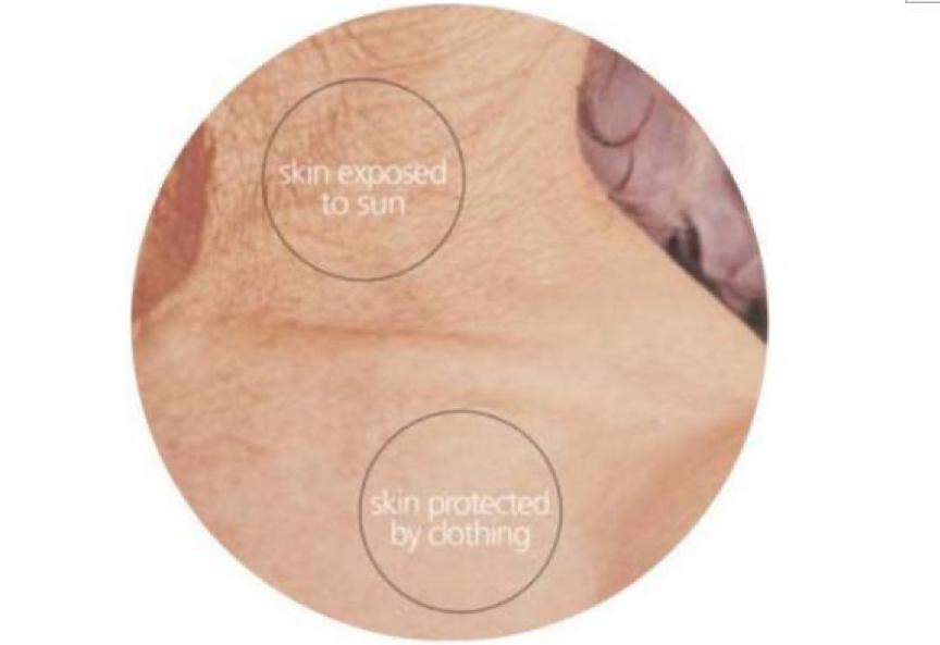 秋季滋润皮肤干燥的汤,秋季怎么保养皮肤