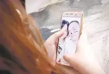 男子被一只狗疯咬,狗被狗咬出血会自愈吗