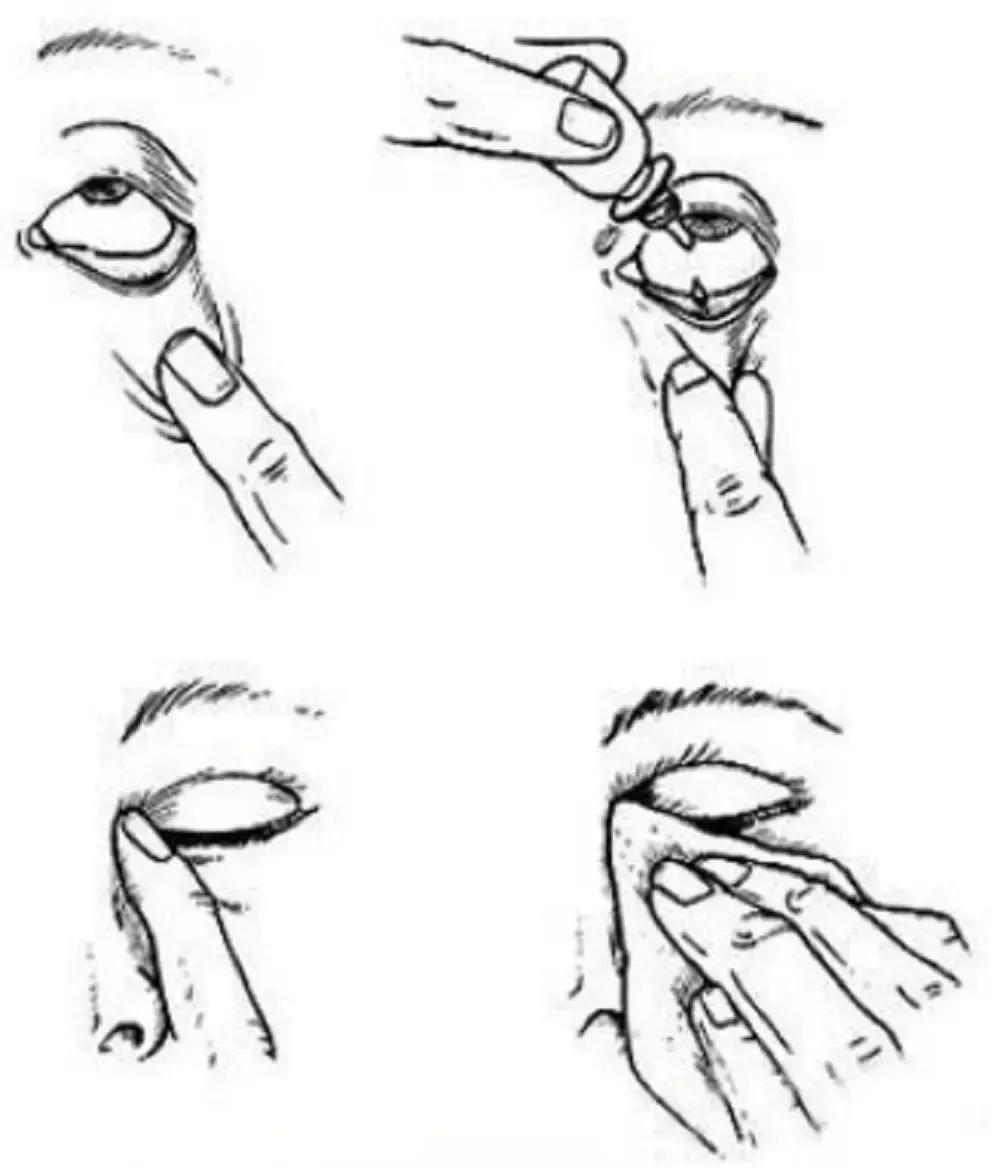 哪些禁售的日本网红眼药水,日本网红眼药水还在卖吗