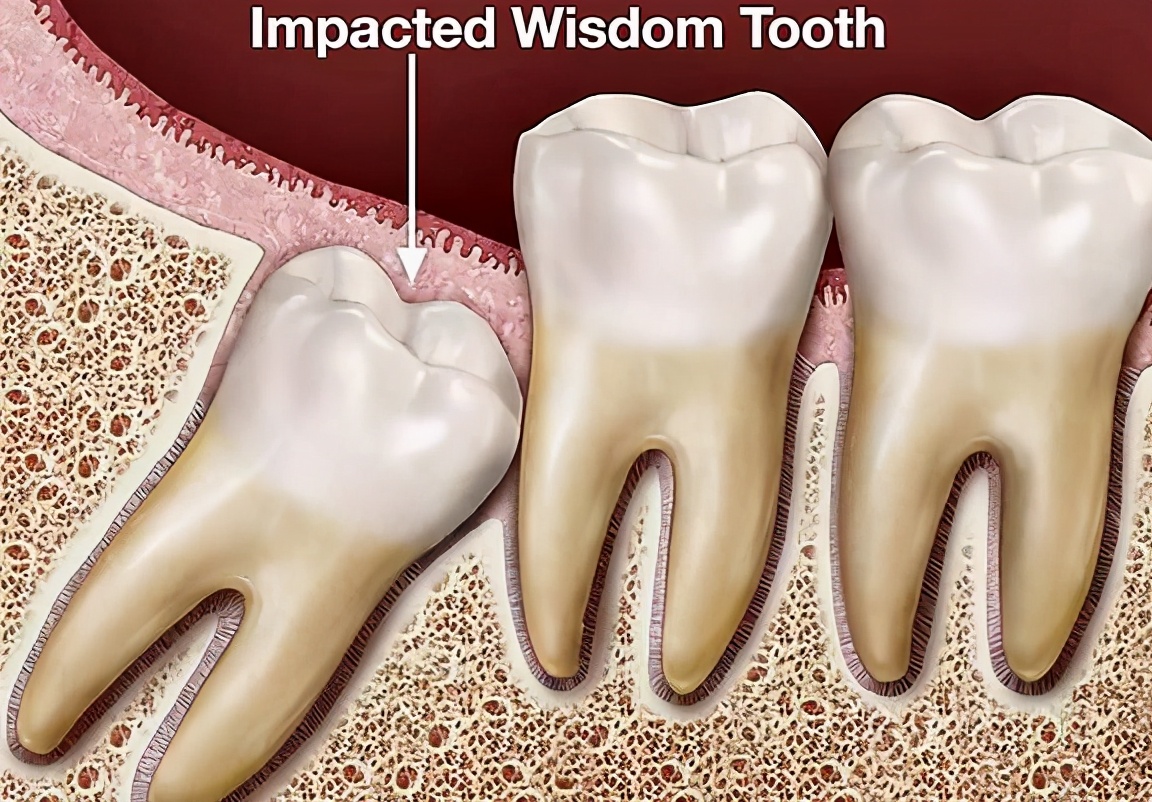 出现5个症状就要警惕牙周炎,出现这5种症状一定要及时治疗
