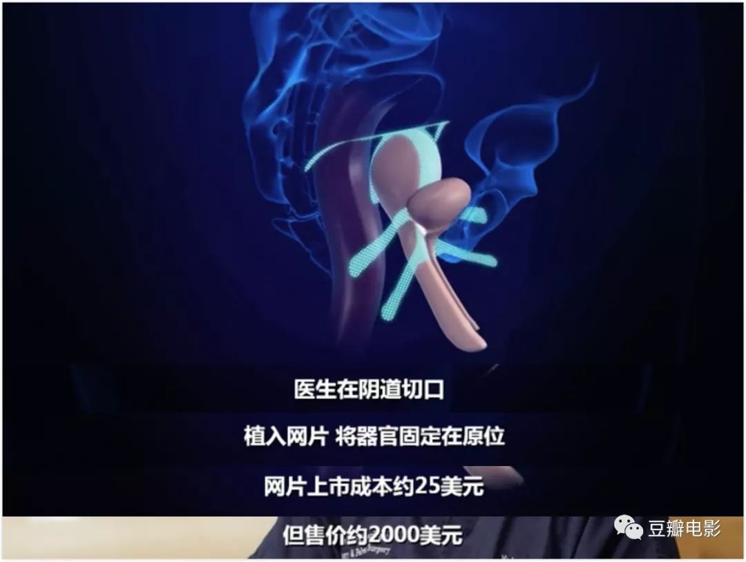 豆瓣9.0，揭露医疗*局骗**，这片太血淋淋