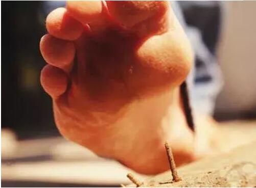 意外受伤一定要打碎伤风针吗,受伤后几天内打碎伤风针有效