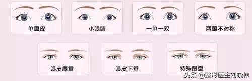 眼睛手术的坑，不要往里面跳了