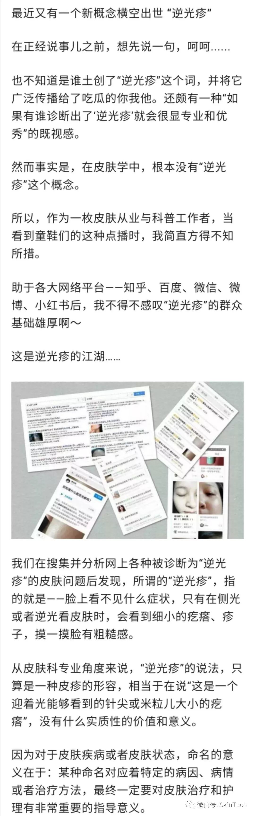 辟谣逆光疹,逆光疹是伪概念吗