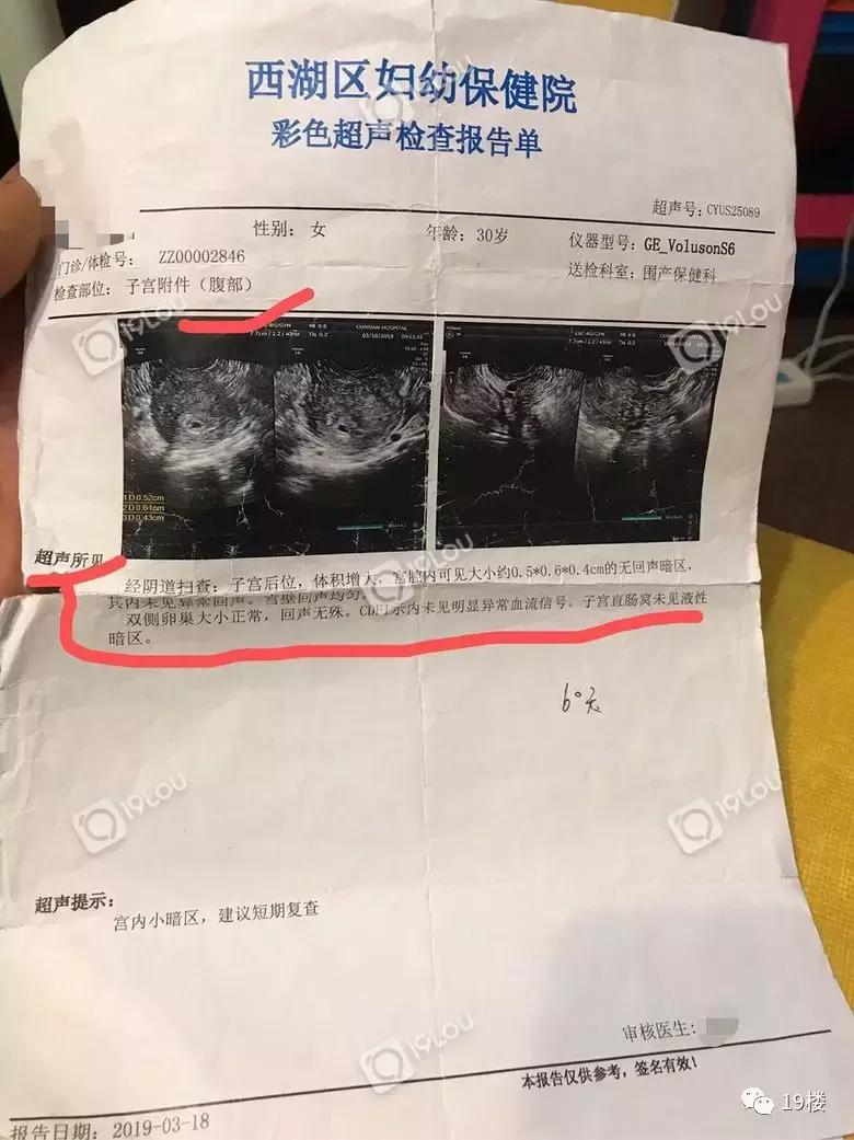 做了检查就流产了,做了ct检查一个月后怀孕了